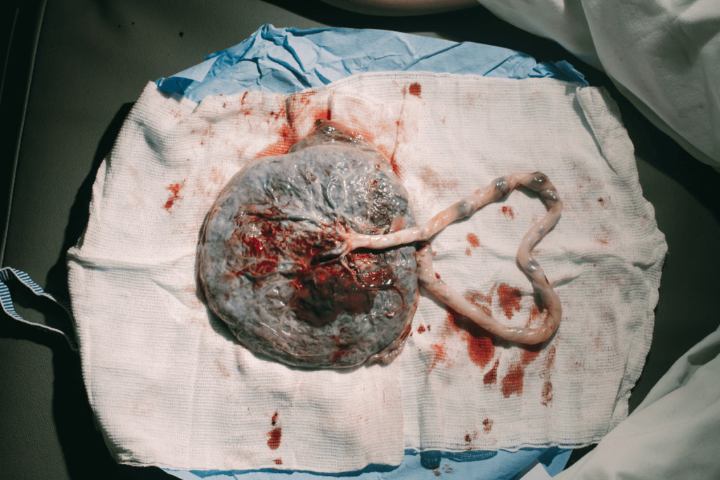 placenta on cloth