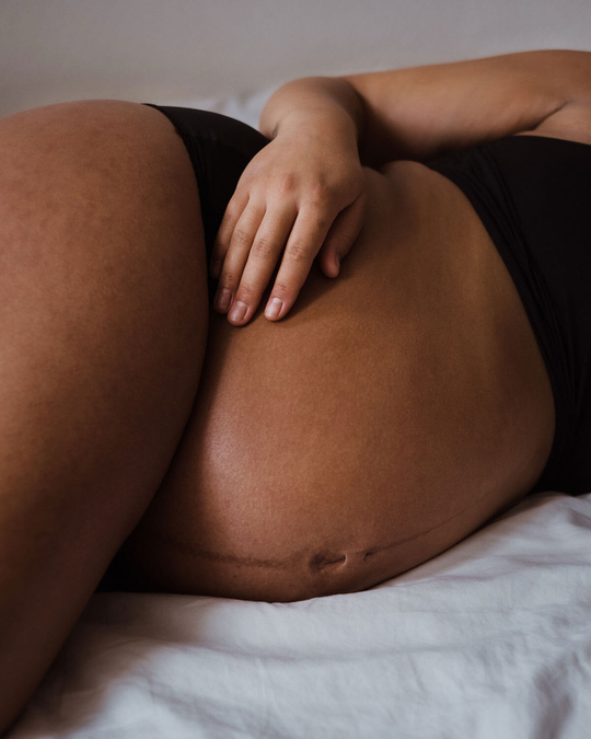 Sleep Your Way to a Healthier Pregnancy