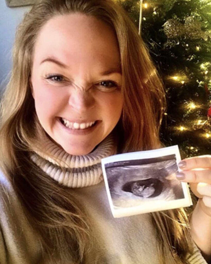 woman holding ultrasound